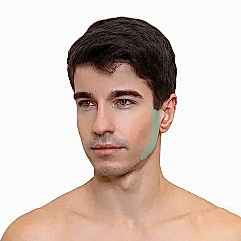 Лазерная эпиляция бакенбарды у мужчин в Алматы