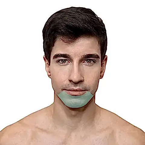 Лазерная эпиляция подбородок у мужчин в Алматы