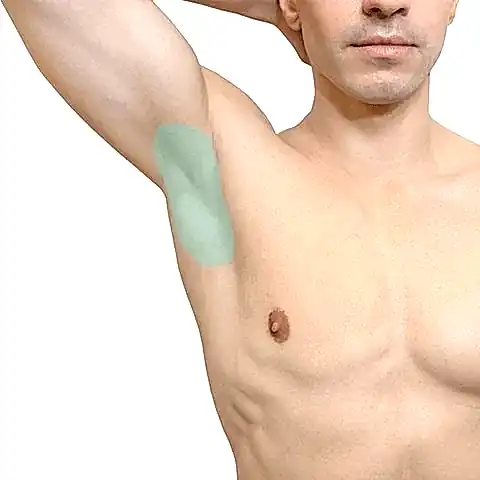 Лазерная эпиляция подмышки у мужчин в Алматы